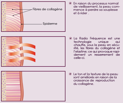 Anti-âge Bordeaux Anti-rides Bordeaux